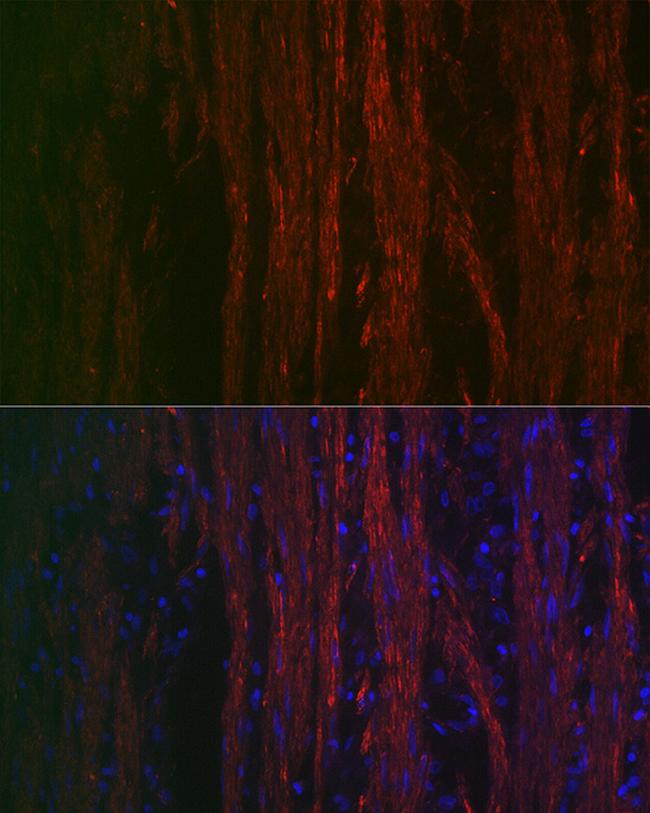 Alpha-Smooth Muscle Actin Antibody in Immunocytochemistry (ICC/IF)