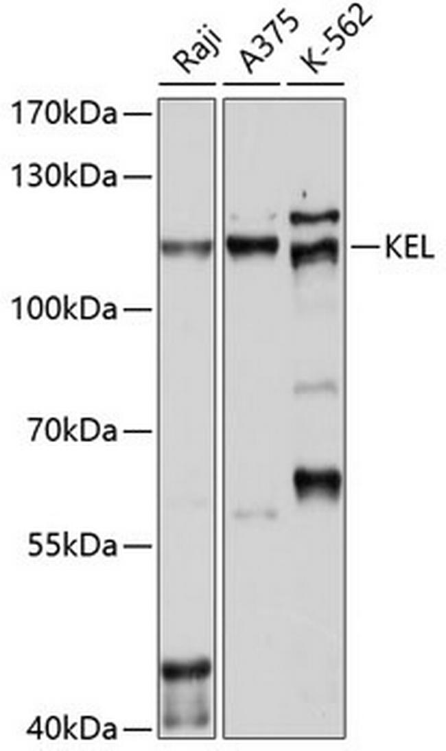 KELL Antibody in Western Blot (WB)