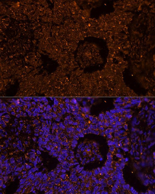 ZP2 Antibody in Immunocytochemistry (ICC/IF)