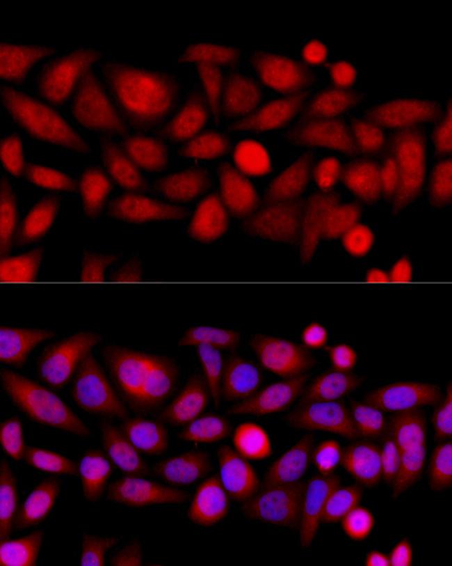 KIF4A Antibody in Immunocytochemistry (ICC/IF)