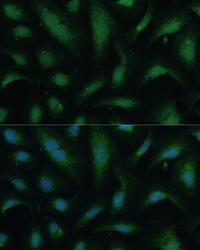 KIF14 Antibody in Immunocytochemistry (ICC/IF)