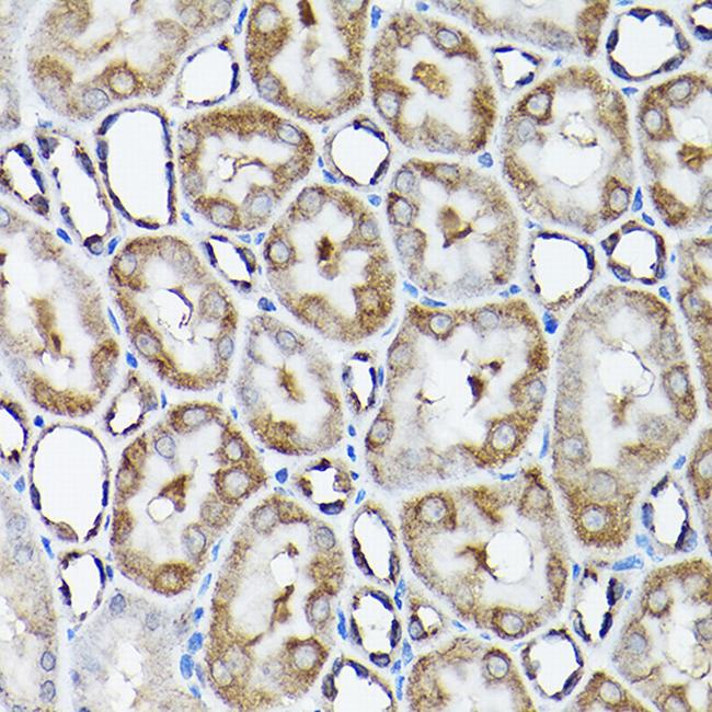 SNAPAP Antibody in Immunohistochemistry (Paraffin) (IHC (P))