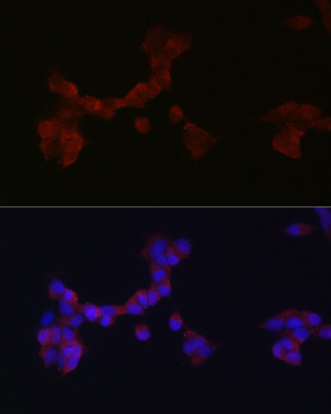 DAB1 Antibody in Immunocytochemistry (ICC/IF)