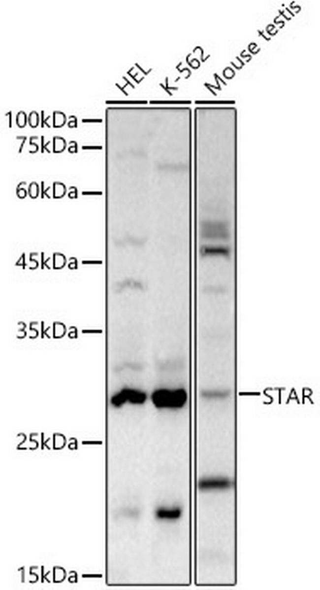 STAR Antibody in Western Blot (WB)