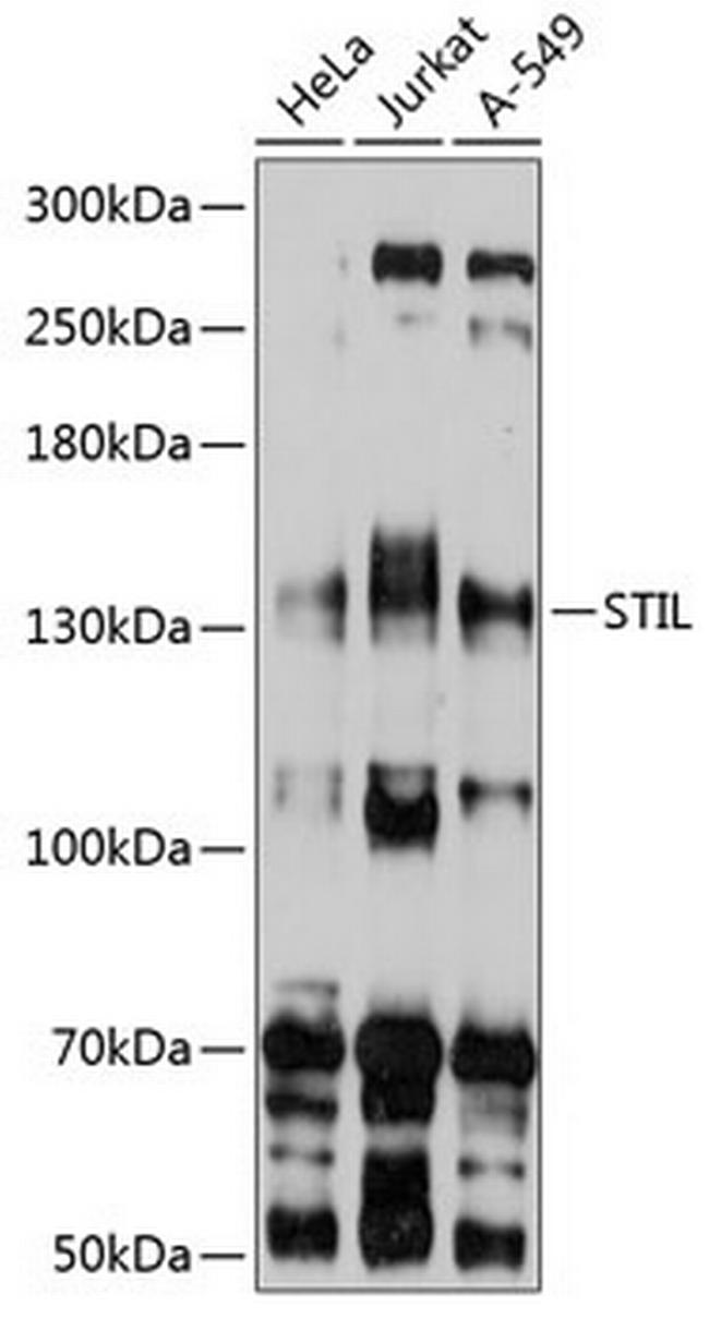 STIL Antibody in Western Blot (WB)