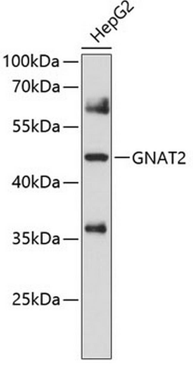 GNAT2 Antibody in Western Blot (WB)