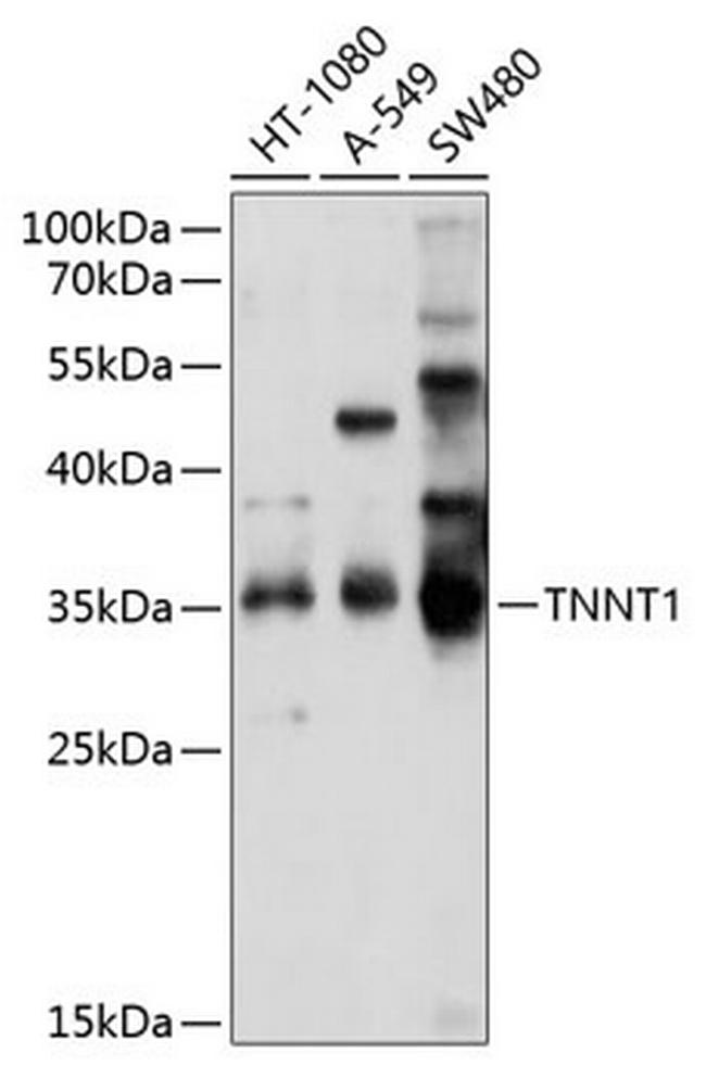 TNNT1 Antibody in Western Blot (WB)