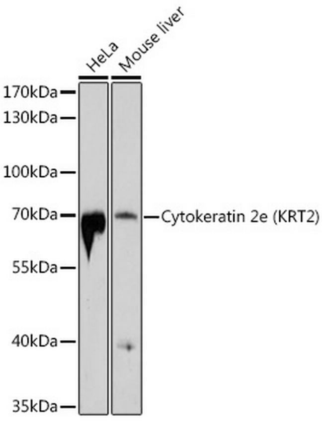 Cytokeratin 2e Antibody in Western Blot (WB)