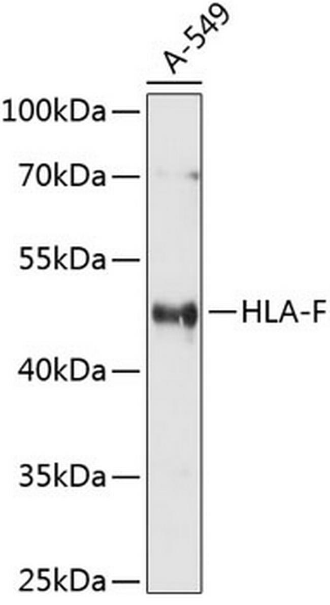 HLA-F Antibody in Western Blot (WB)