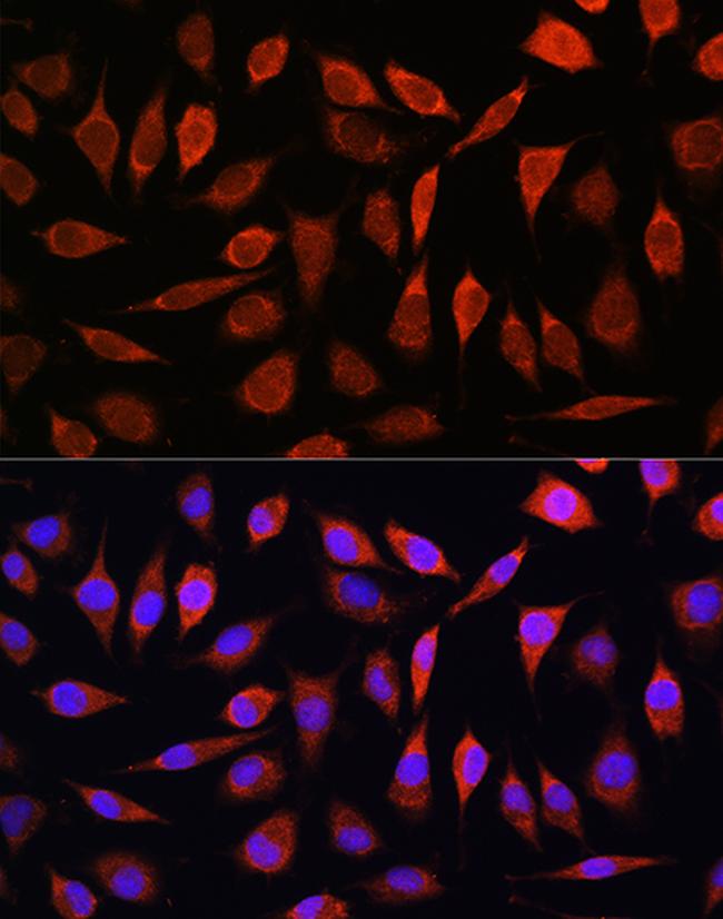 SLC39A8 Antibody in Immunocytochemistry (ICC/IF)