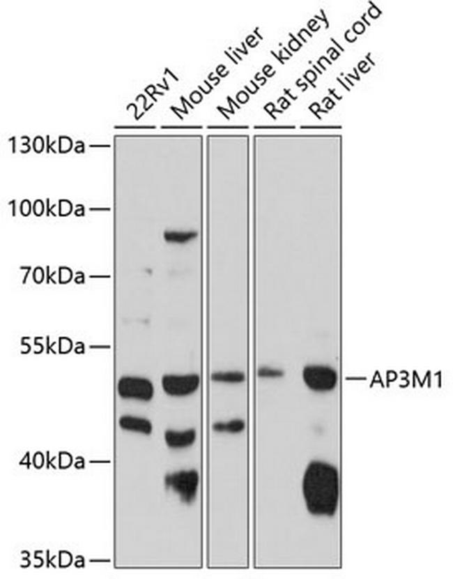 AP3M1 Antibody in Western Blot (WB)