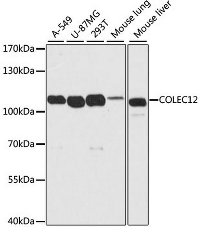 COLEC12 Antibody in Western Blot (WB)