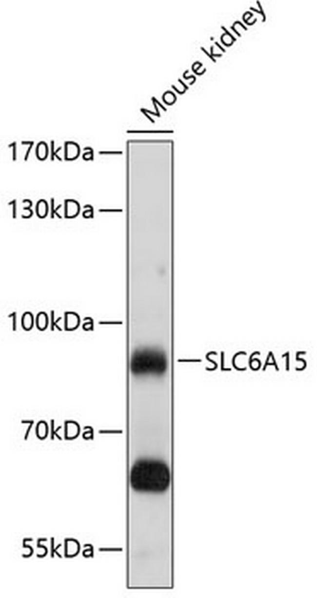 SLC6A15 Antibody in Western Blot (WB)