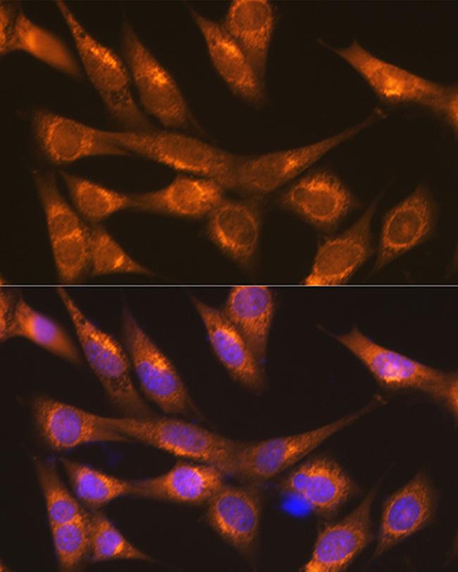 LMAN1 Antibody in Immunocytochemistry (ICC/IF)