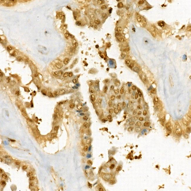 Thymidylate Synthase Antibody in Immunohistochemistry (Paraffin) (IHC (P))