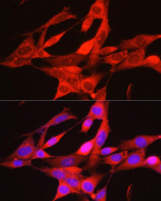 PHGDH Antibody in Immunocytochemistry (ICC/IF)