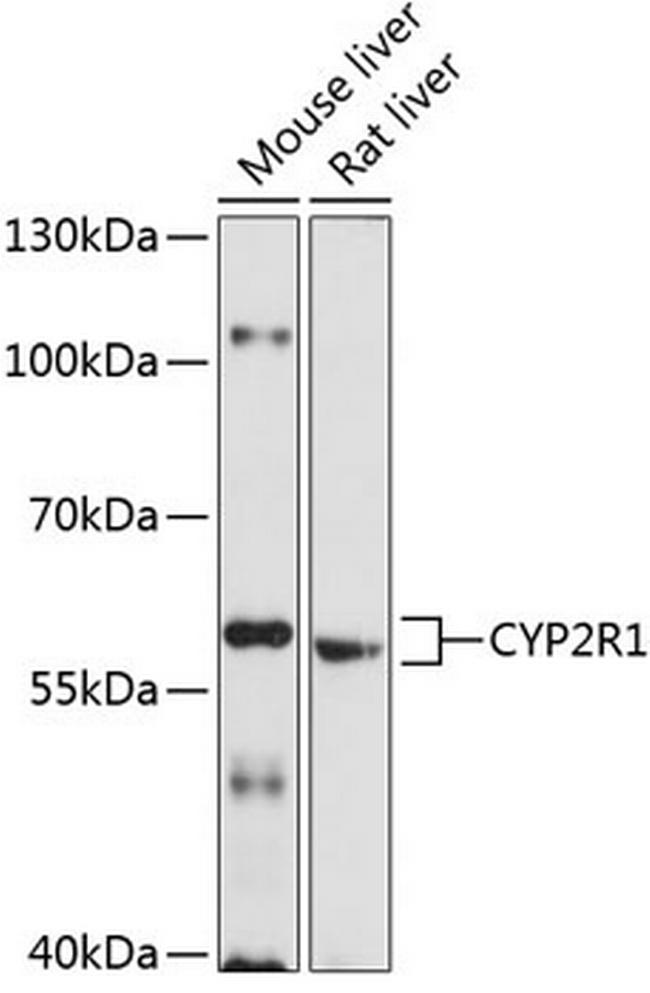 CYP2R1 Antibody in Western Blot (WB)