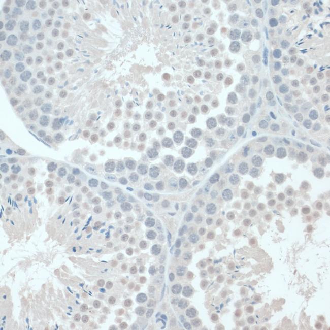 GAPDHS Antibody in Immunohistochemistry (Paraffin) (IHC (P))