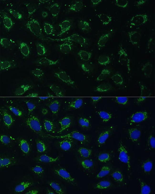 AKR1C2 Antibody in Immunocytochemistry (ICC/IF)