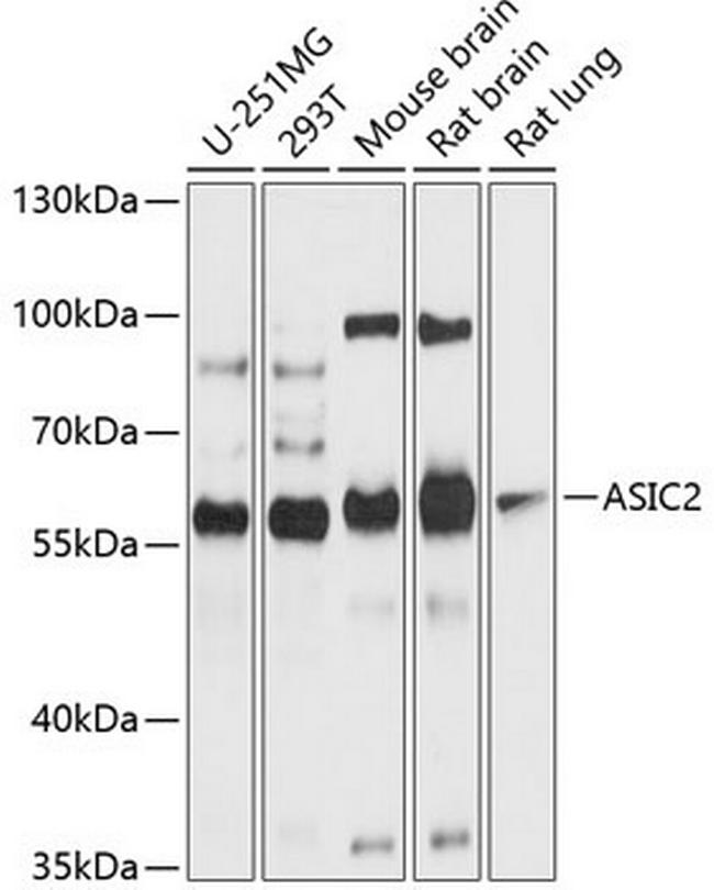 ASIC2 Antibody in Western Blot (WB)