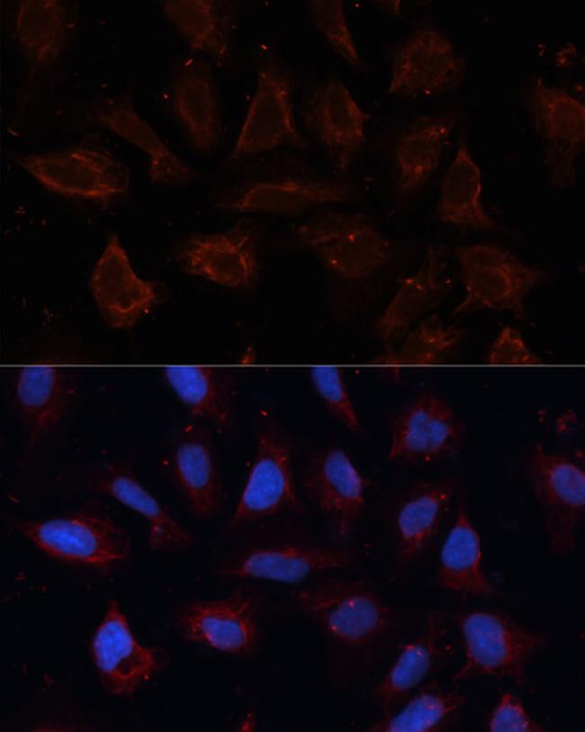 DOG-1 Antibody in Immunocytochemistry (ICC/IF)