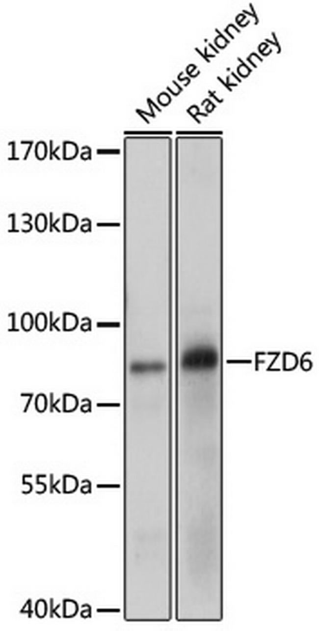 FZD6 Antibody in Western Blot (WB)