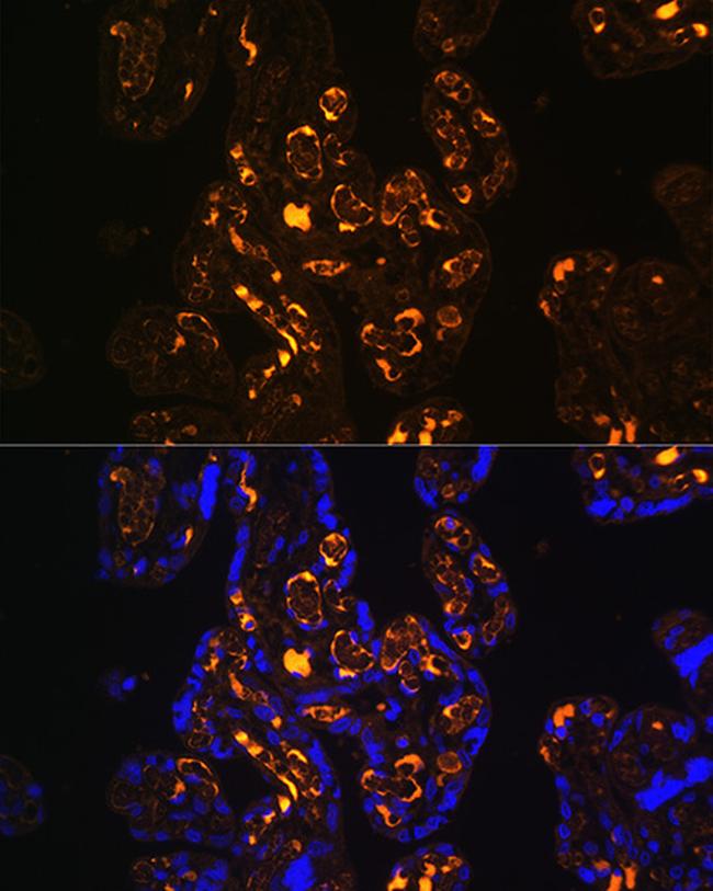 LRP8 Antibody in Immunohistochemistry (Paraffin) (IHC (P))