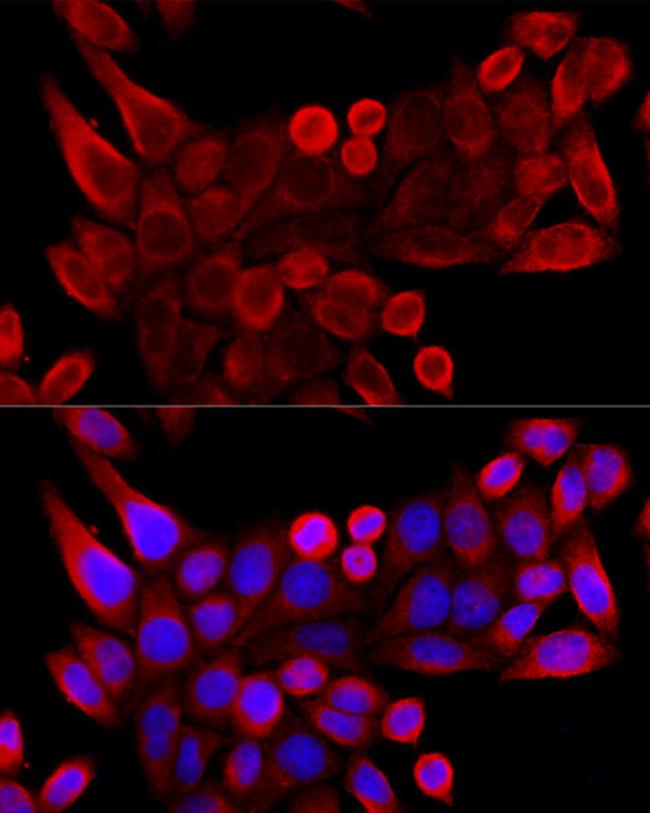 VDAC3 Antibody in Immunocytochemistry (ICC/IF)