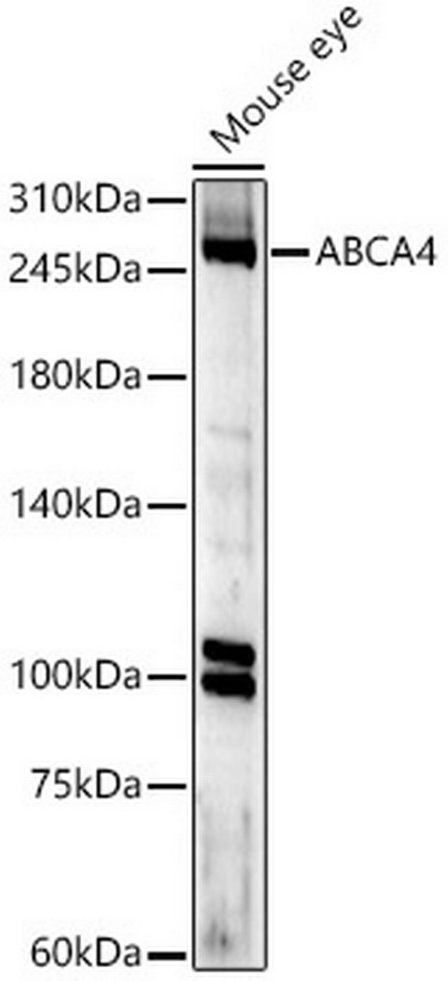 ABCA4 Antibody in Western Blot (WB)