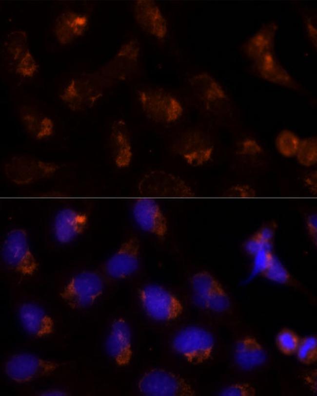 SEC14L2 Antibody in Immunocytochemistry (ICC/IF)