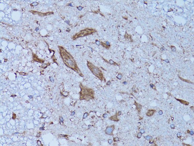 HADH Antibody in Immunohistochemistry (Paraffin) (IHC (P))