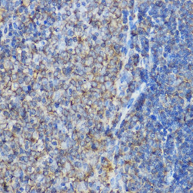 ARPC2 Antibody in Immunohistochemistry (Paraffin) (IHC (P))