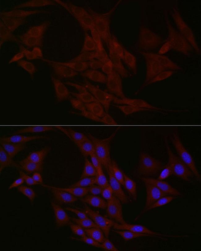 NTF4 Antibody in Immunocytochemistry (ICC/IF)