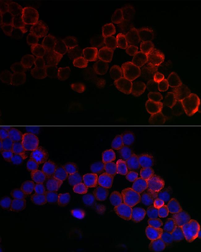 GPX1 Antibody in Immunocytochemistry (ICC/IF)