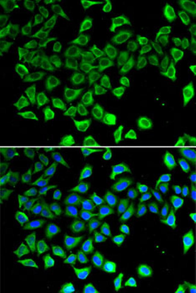 NGAL Antibody in Immunocytochemistry (ICC/IF)