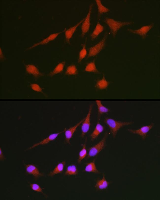 Nrf2 Antibody in Immunocytochemistry (ICC/IF)