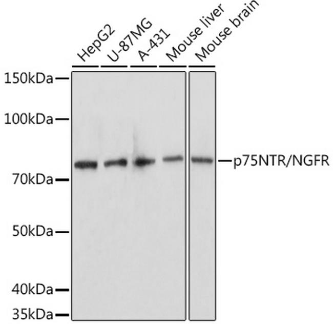 NGF Receptor Antibody in Western Blot (WB)