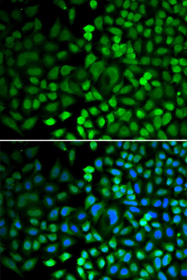 APE1 Antibody in Immunocytochemistry (ICC/IF)