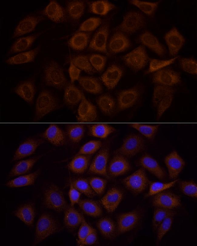 PI3K p85 alpha Antibody in Immunocytochemistry (ICC/IF)