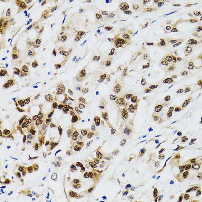 p53 Antibody in Immunohistochemistry (Paraffin) (IHC (P))