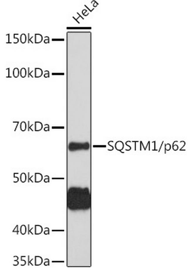 SQSTM1 Antibody in Western Blot (WB)