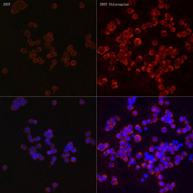 LC3B Antibody in Immunocytochemistry (ICC/IF)