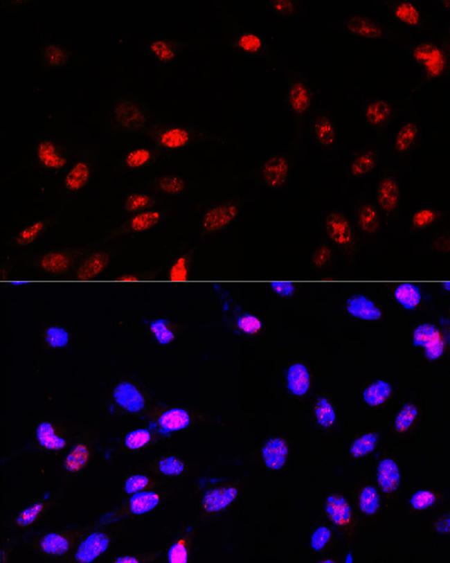 TCF4 Antibody in Immunocytochemistry (ICC/IF)