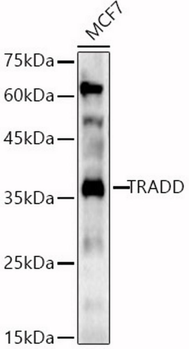 TRADD Antibody in Western Blot (WB)