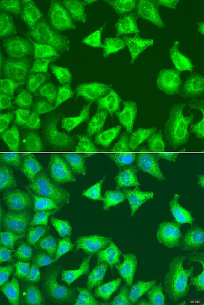 SQSTM1 Antibody in Immunocytochemistry (ICC/IF)