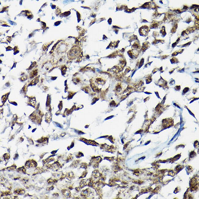 SMAD2 Antibody in Immunohistochemistry (Paraffin) (IHC (P))