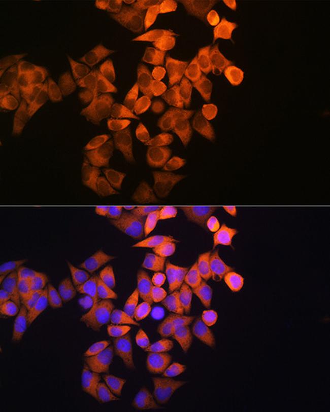 RRM1 Antibody in Immunocytochemistry (ICC/IF)