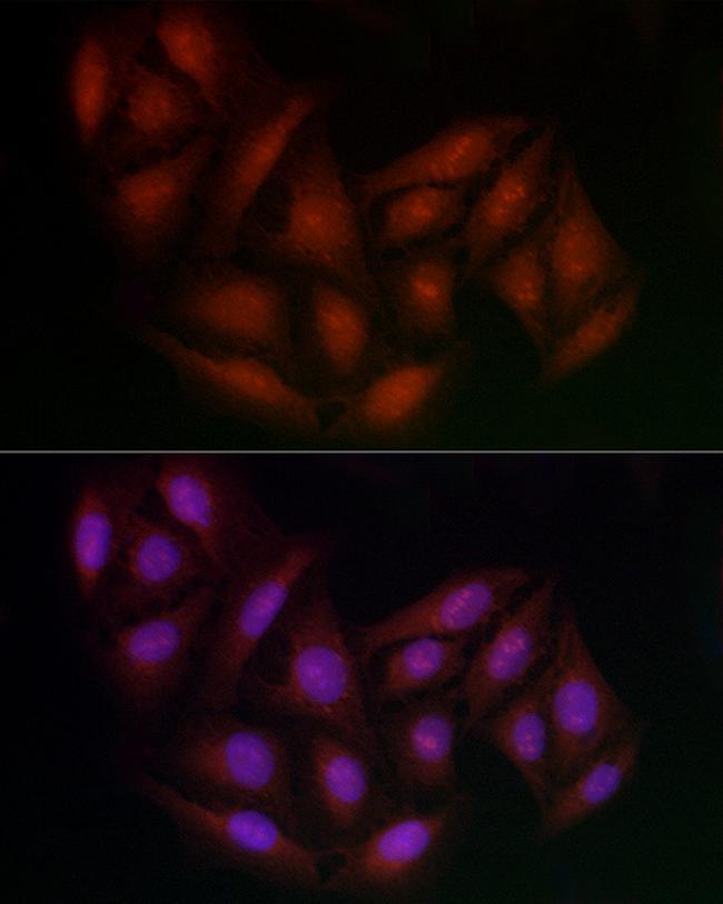 BRCA1 Antibody in Immunocytochemistry (ICC/IF)