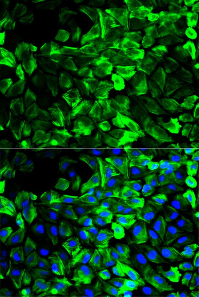 TPM1 Antibody in Immunocytochemistry (ICC/IF)