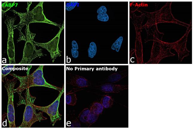 FABP7 Antibody in Immunocytochemistry (ICC/IF)